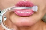 Anti-Ageing Straws