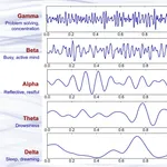 Binaural Beats