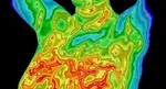 Thermography in New Zealand