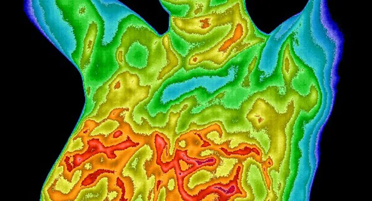 Thermography in New Zealand