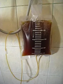 Apple Cider Vinegar