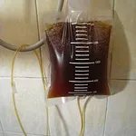 Apple Cider Vinegar