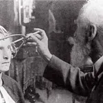 The Cephalic Index: A Vanished Pseudoscience